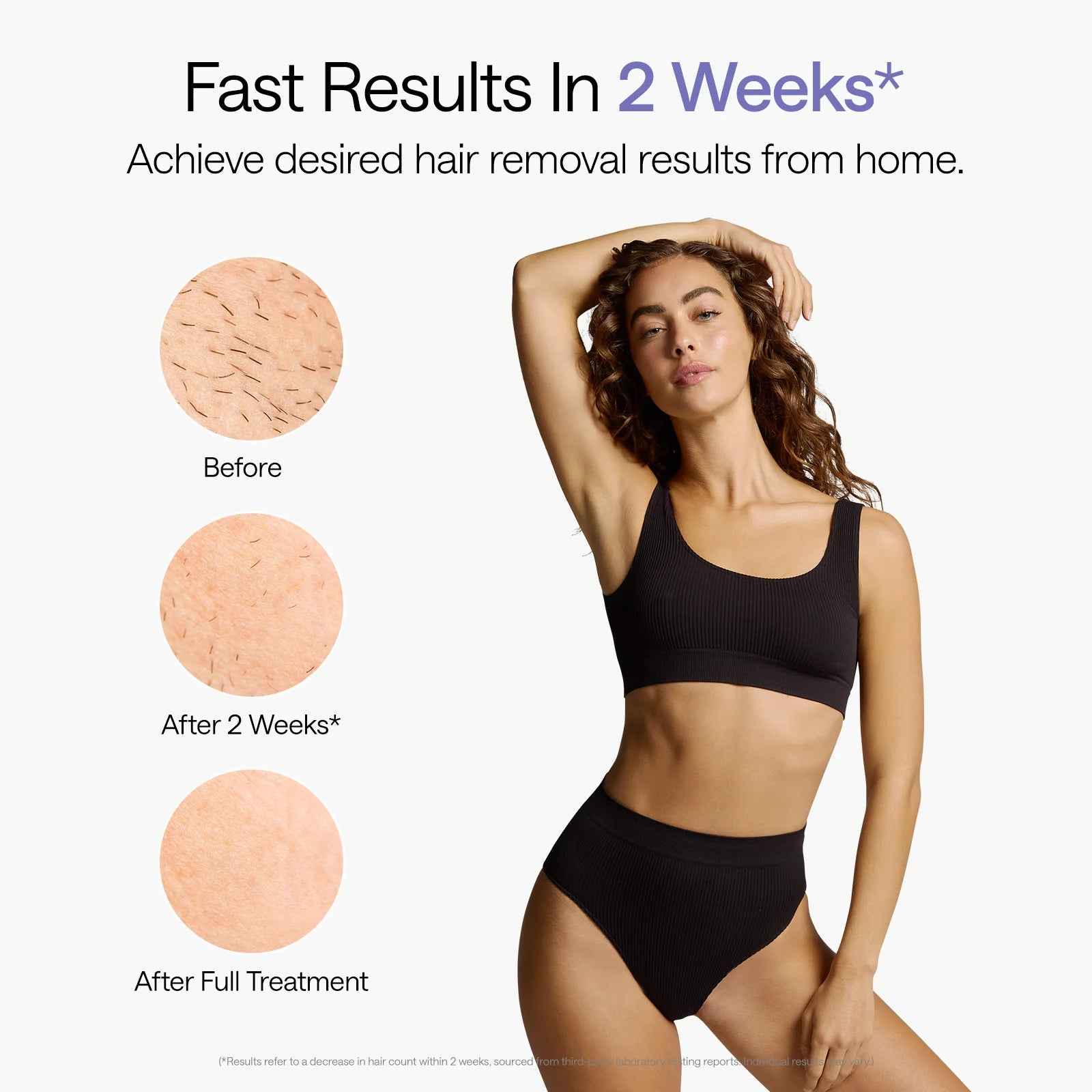 Air 10 Next-Gen IPL Hair Removal | FDA-Cleared for Results in 2 Weeks - Essence Bleu