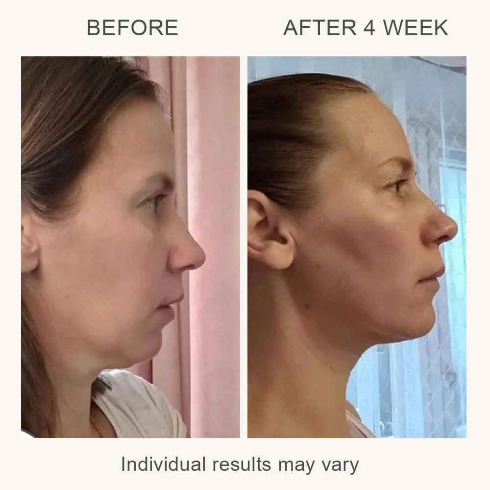 MAMI 4-in-1 LED Facial Massager | Hot & Cold Therapy with Vibration for Anti-Aging, Sculpting & Acne - Essence Bleu