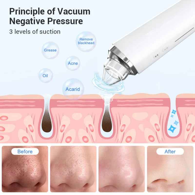 Beauty Multifunctional Cleaning and Beauty Instrument App Control Wifi Visual Pore with Camera - Essence Bleu