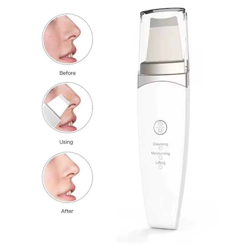New Facial Ultrasonic Skin Scrubber Spatula Deep Face Cleaning Blackhead Remover Face Lift Machine Peeling Shovel Pore Cleaner