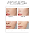 Facial Beauty Massage Device Electric Face Clean Massager Face Skin Care Skin Rejuvenation Beauty Machine Home Devices