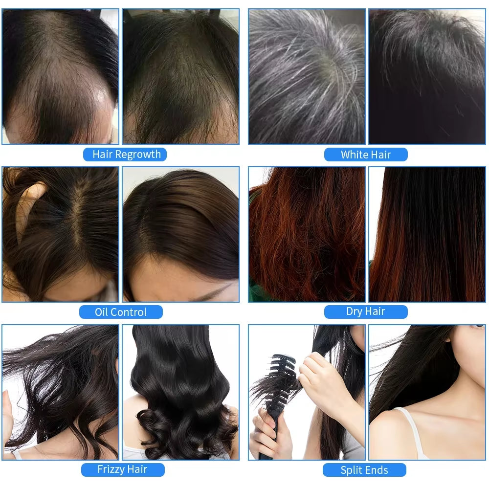 7-in-1 Hair Growth Comb with Red Light, RF & EMS | Anti-Hair Loss Therapy - Essence Bleu