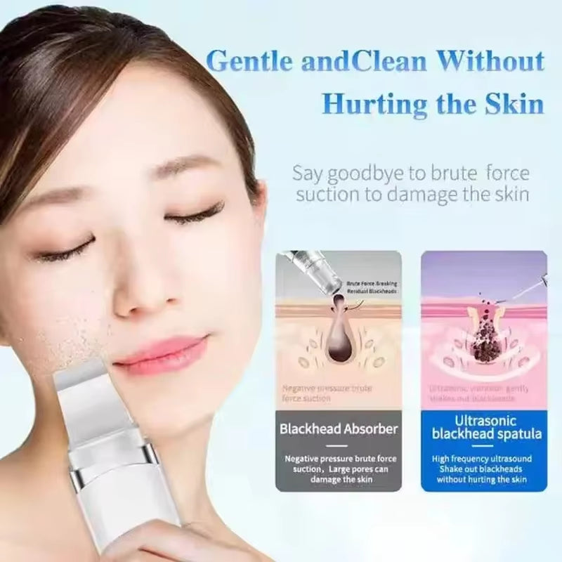 New Facial Ultrasonic Skin Scrubber Spatula Deep Face Cleaning Blackhead Remover Face Lift Machine Peeling Shovel Pore Cleaner