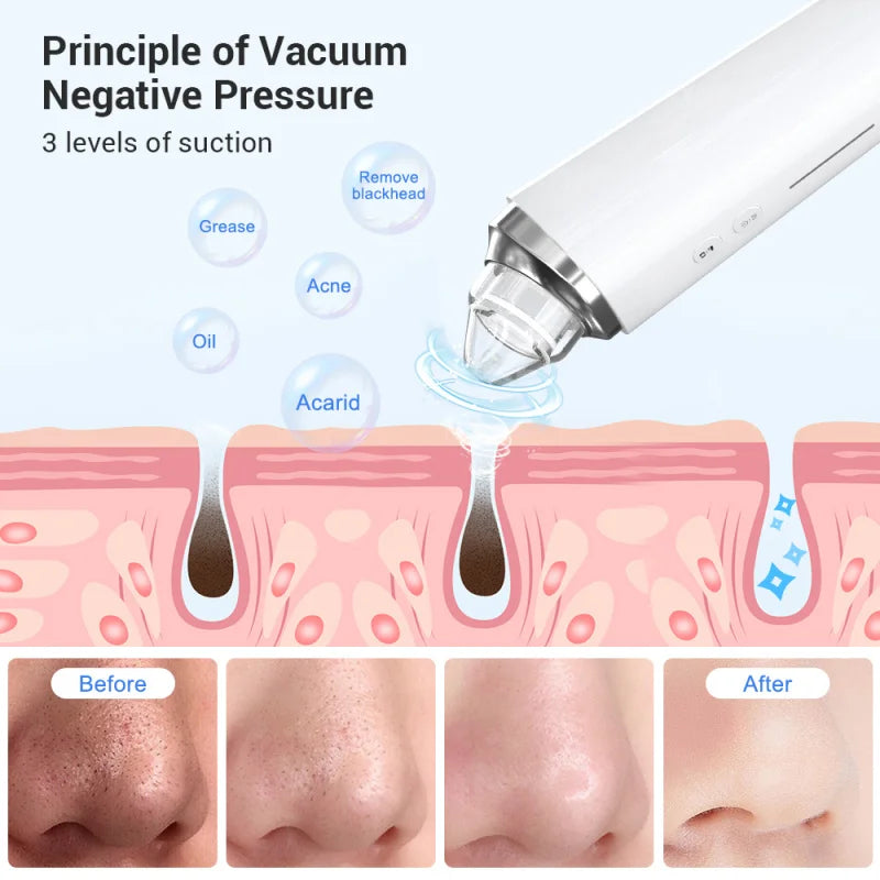 Beauty Multifunctional Cleaning and Beauty Instrument App Control Wifi Visual Pore with Camera