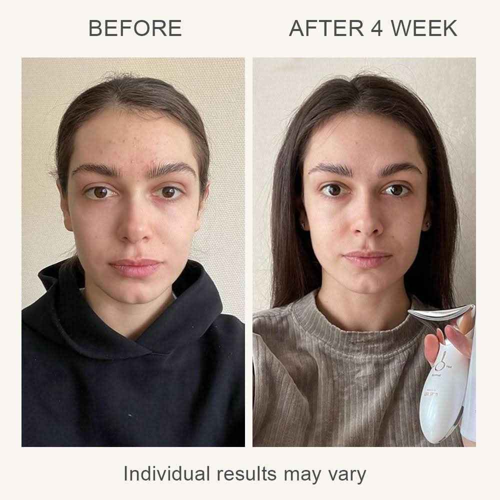 MAMI 4-in-1 LED Facial Massager | Hot & Cold Therapy with Vibration for Anti-Aging, Sculpting & Acne - Essence Bleu